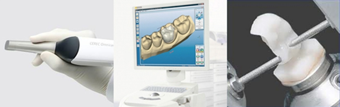 компьютерное моделирование, при котором с зубов можно не снимать слепки