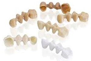 Циркониевые блоки имеют некоторый диапозон оттенков от более светлого до более темного