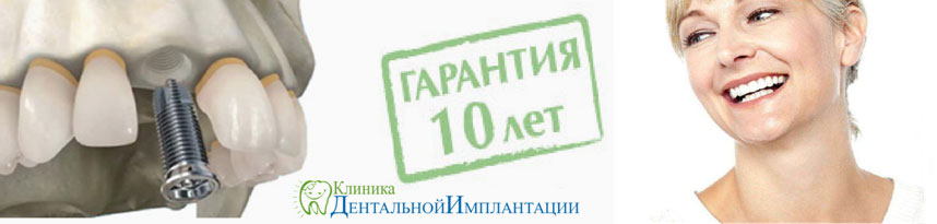 Гарантия на импланты зубов